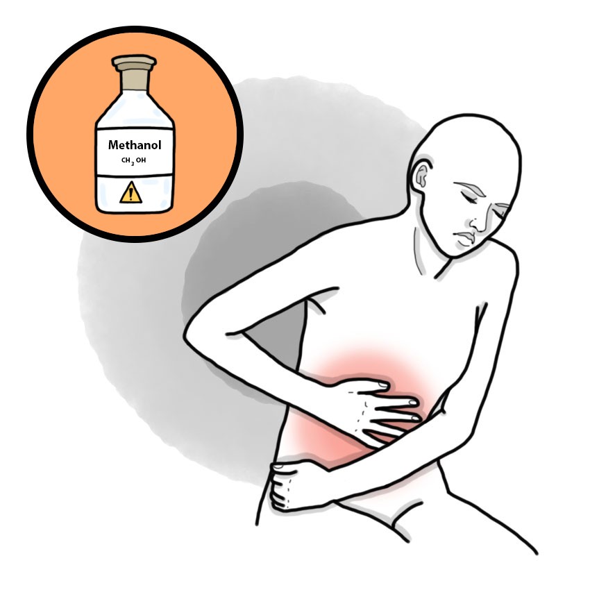 Methanol poisoning