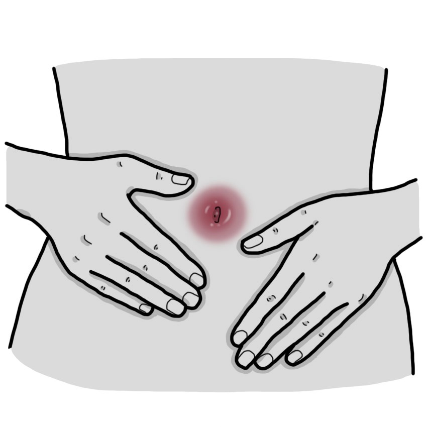 Ontstoken en/of rode navel