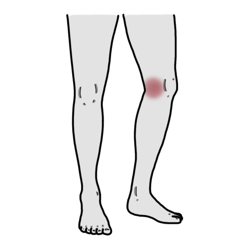 Dor na zona lateral interna do joelho