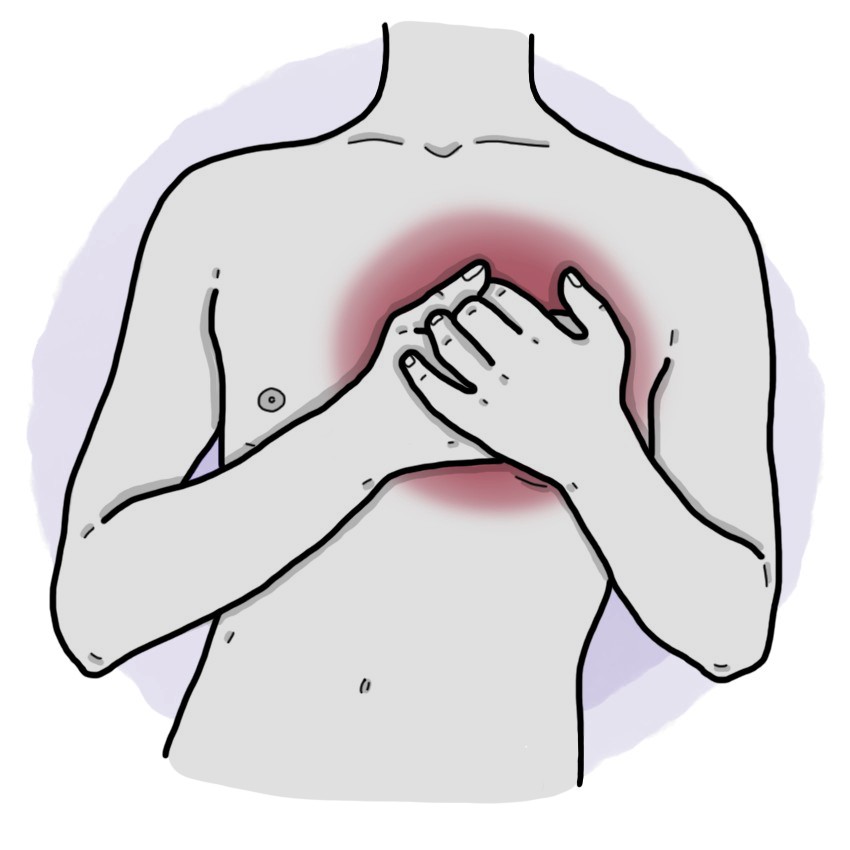 Angina pectoris - Acute coronary syndrome without ST elevation