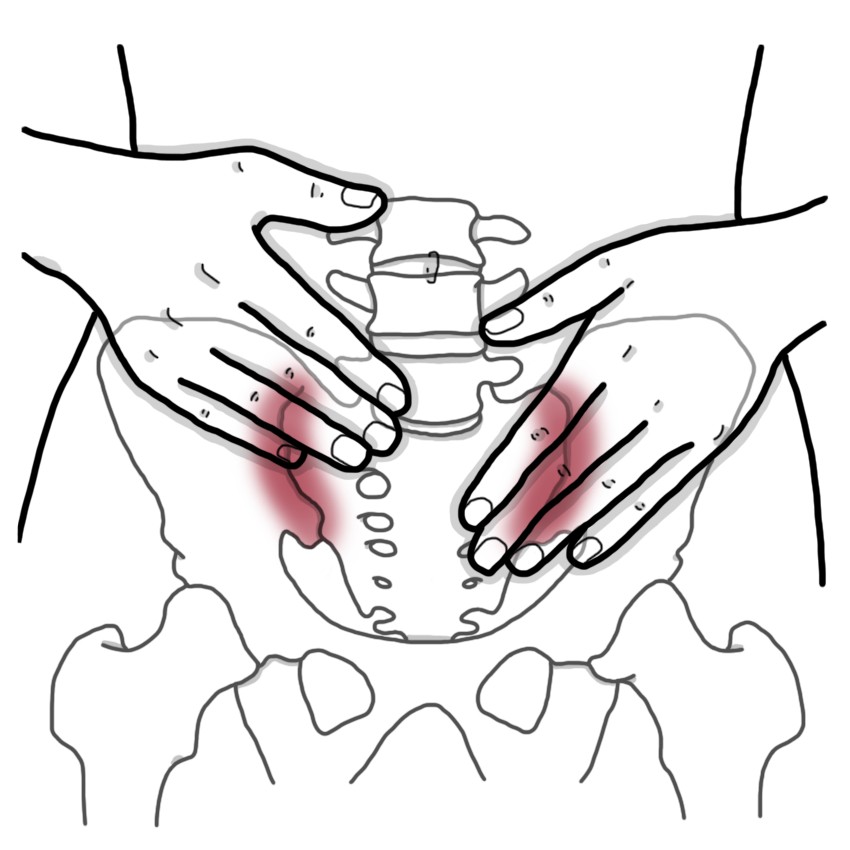 Sacroiliac joint dysfunction