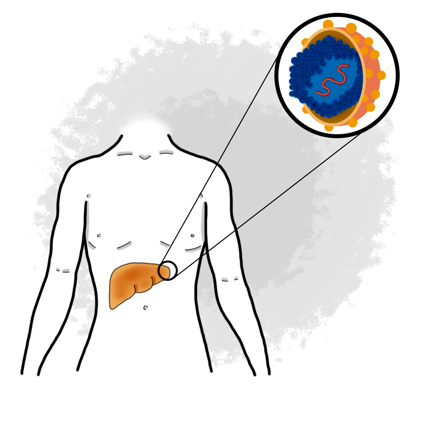 Acute hepatitis due to hepatitis C virus