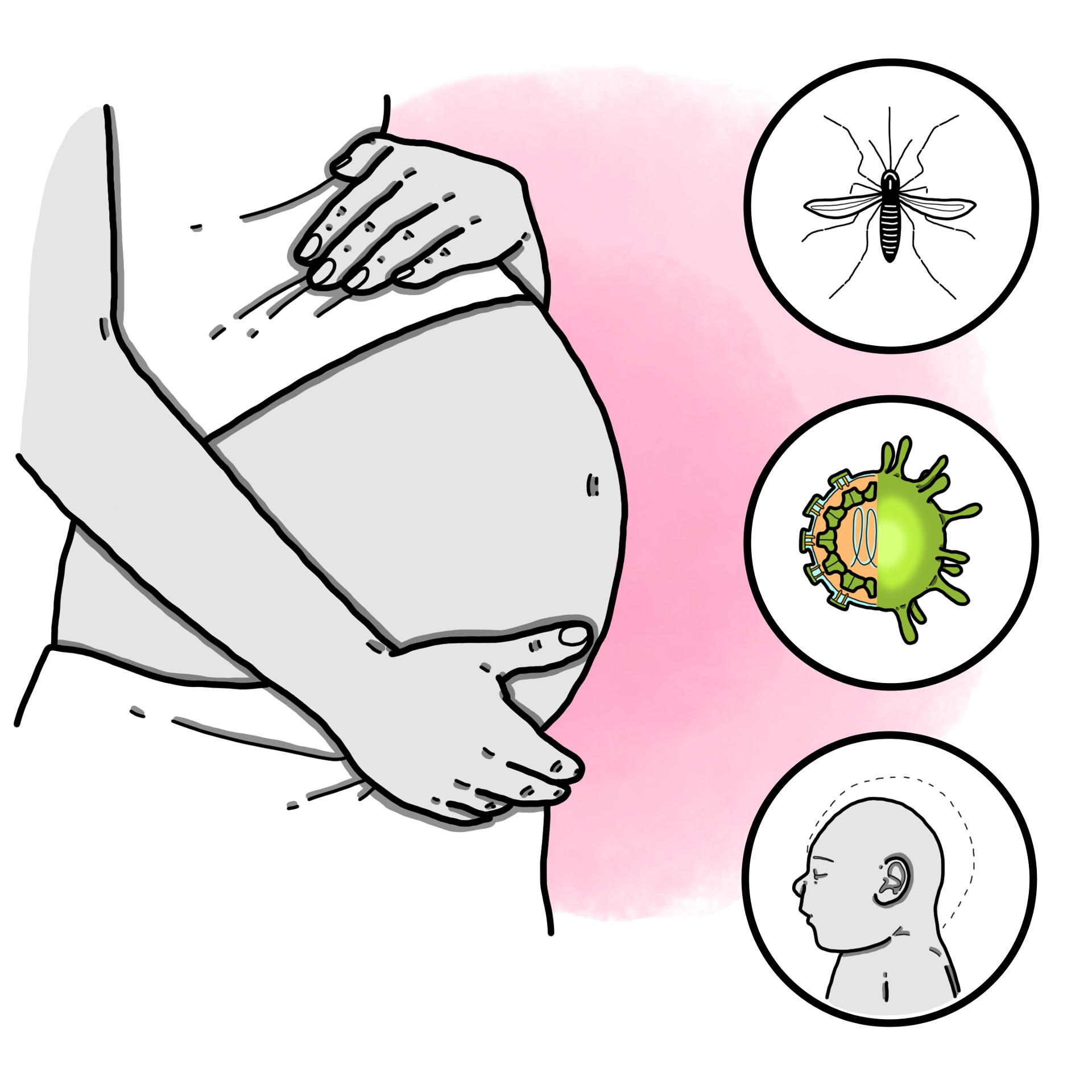 Zika virus infection