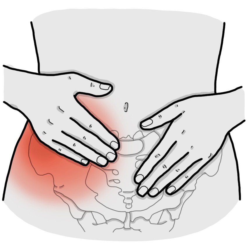 Tek taraflı kalça ağrısı