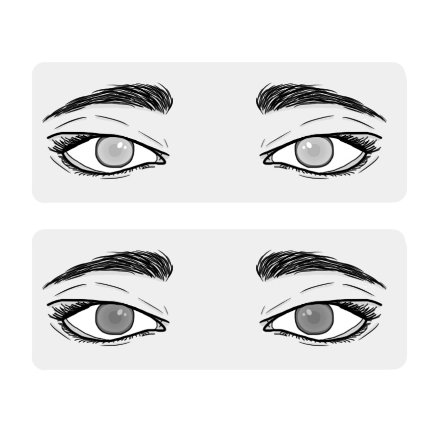 عتامة في العين