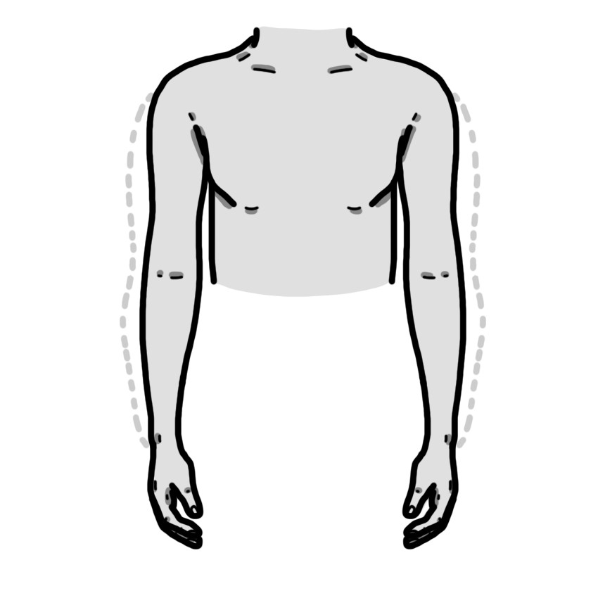 Atrofia muscular en ambos brazos