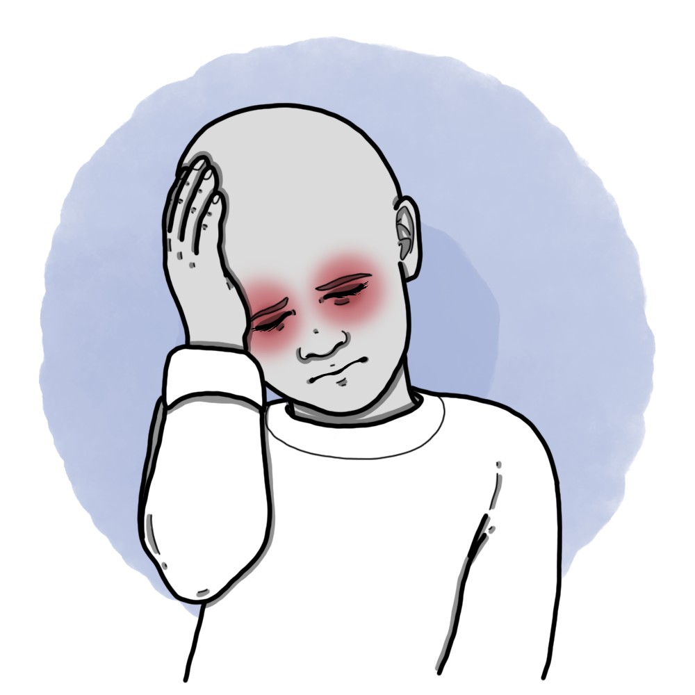 Cluster or Horton's headache (Paediatrics)