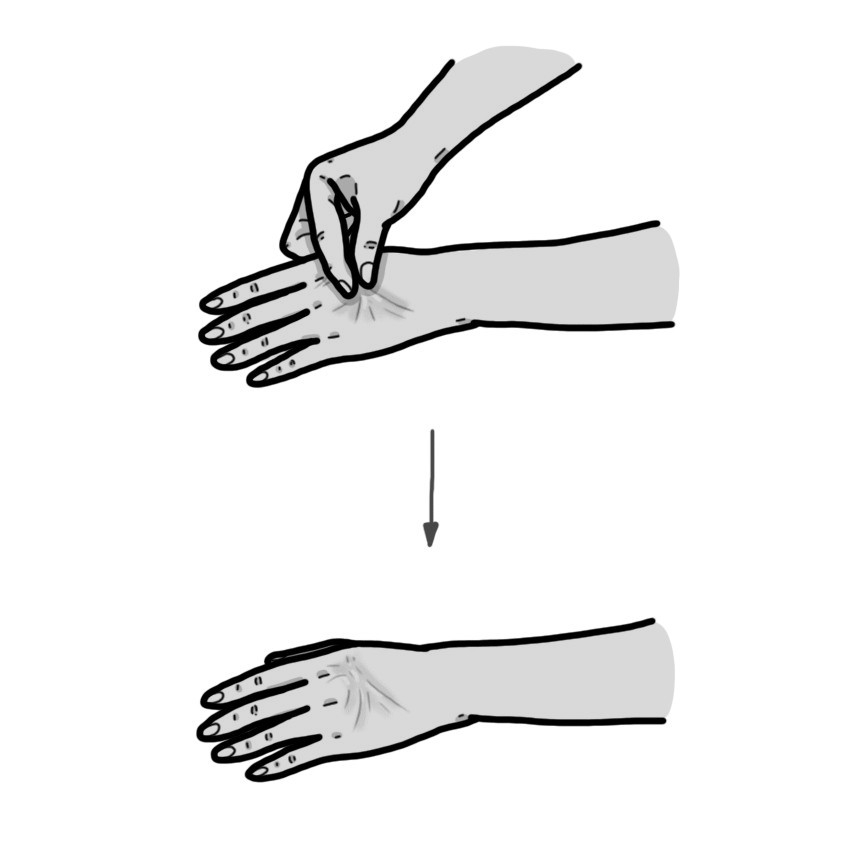 Signes de deshidratació