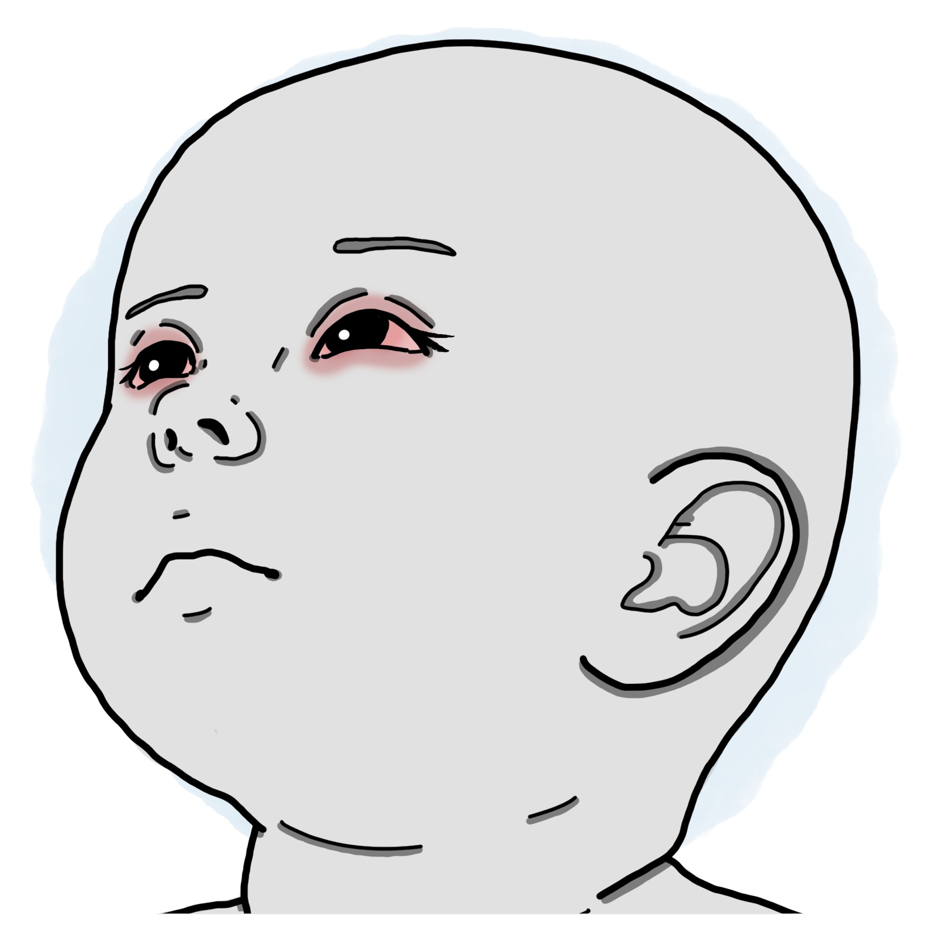 Allergic conjunctivitis (Paediatrics)