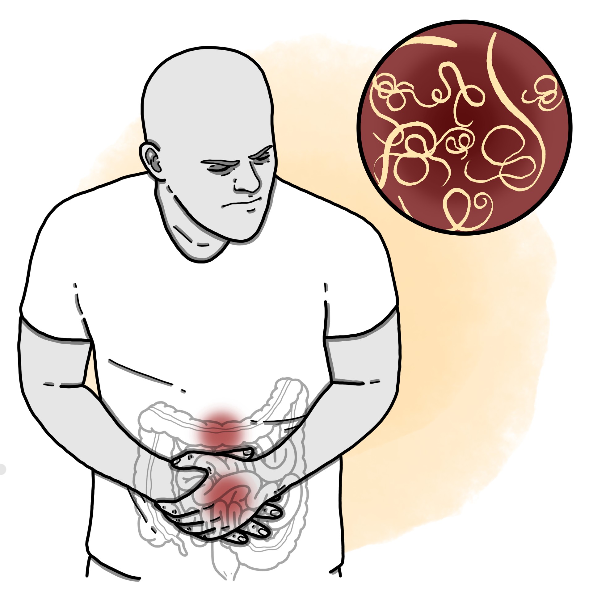 Intestinal helminthiasis