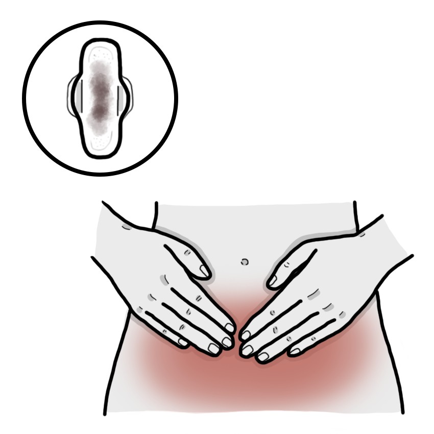 Flujo vaginal oscuro, marronáceo