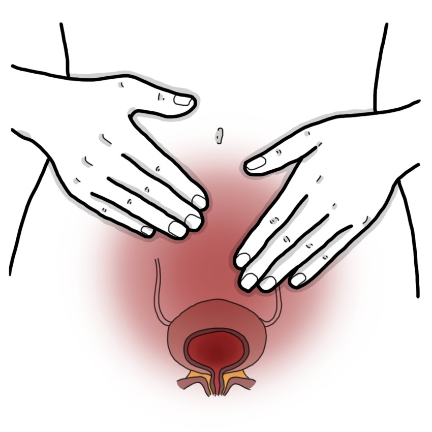 Urinary tract infection - Cystitis (Paediatrics)