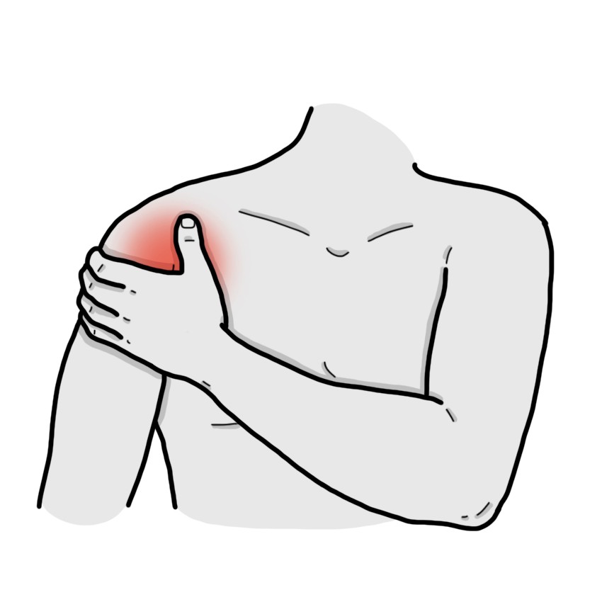 Soreness in the front and side of the shoulder