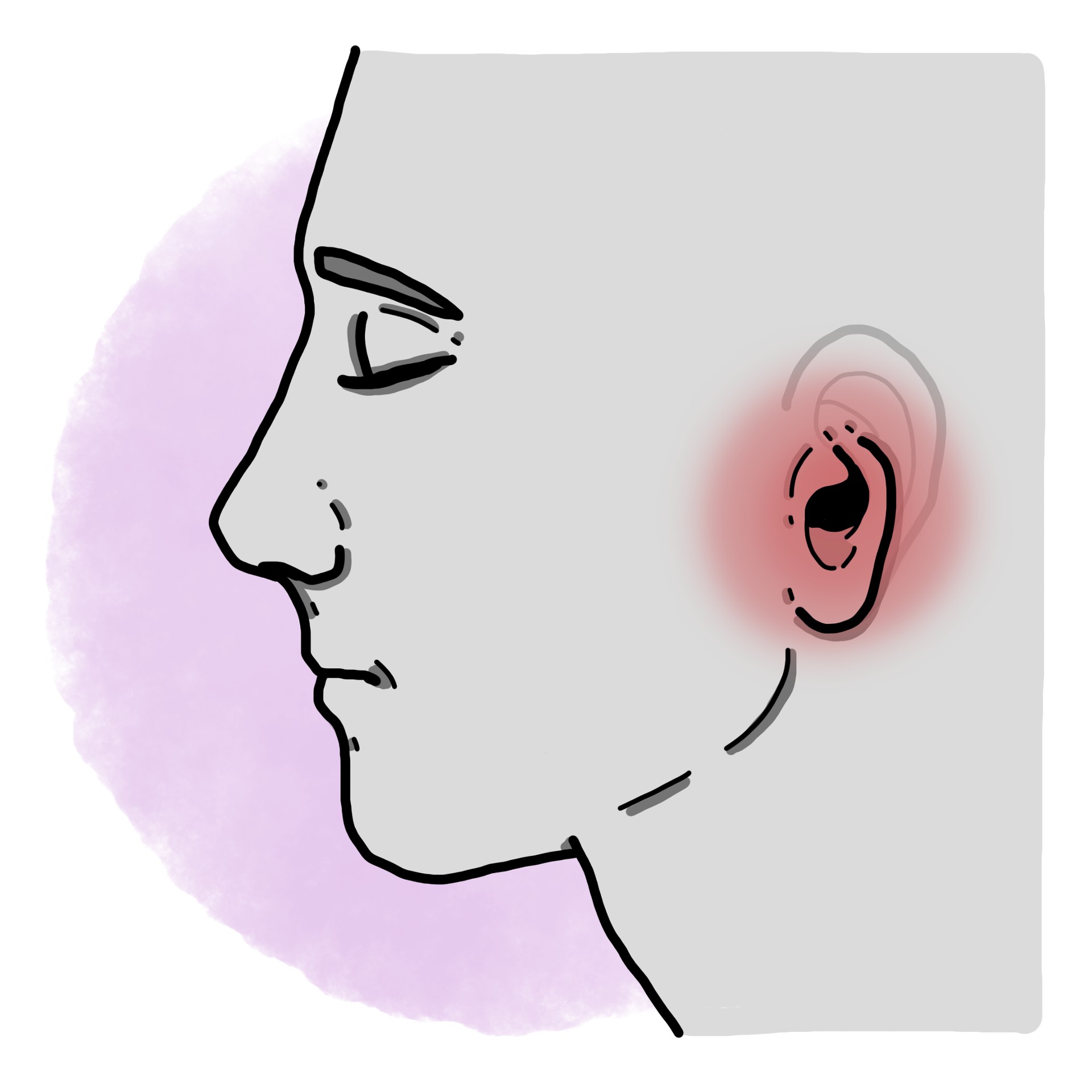 Ear amputation