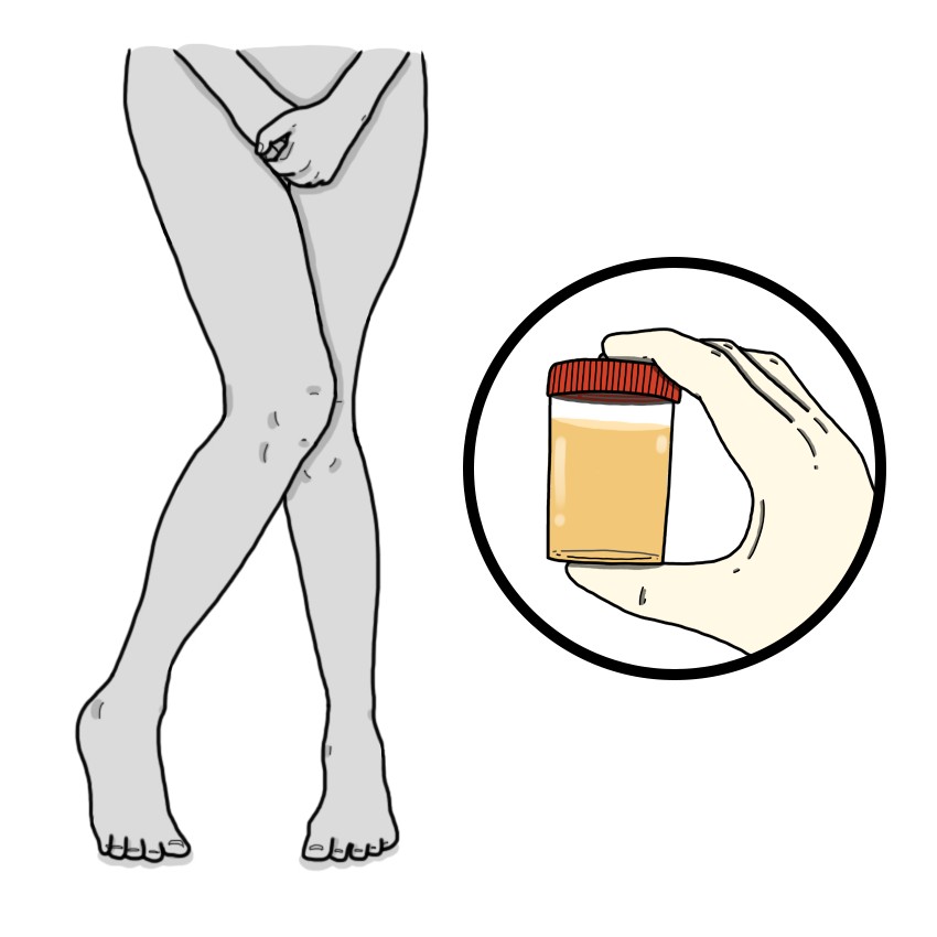 Poliuria