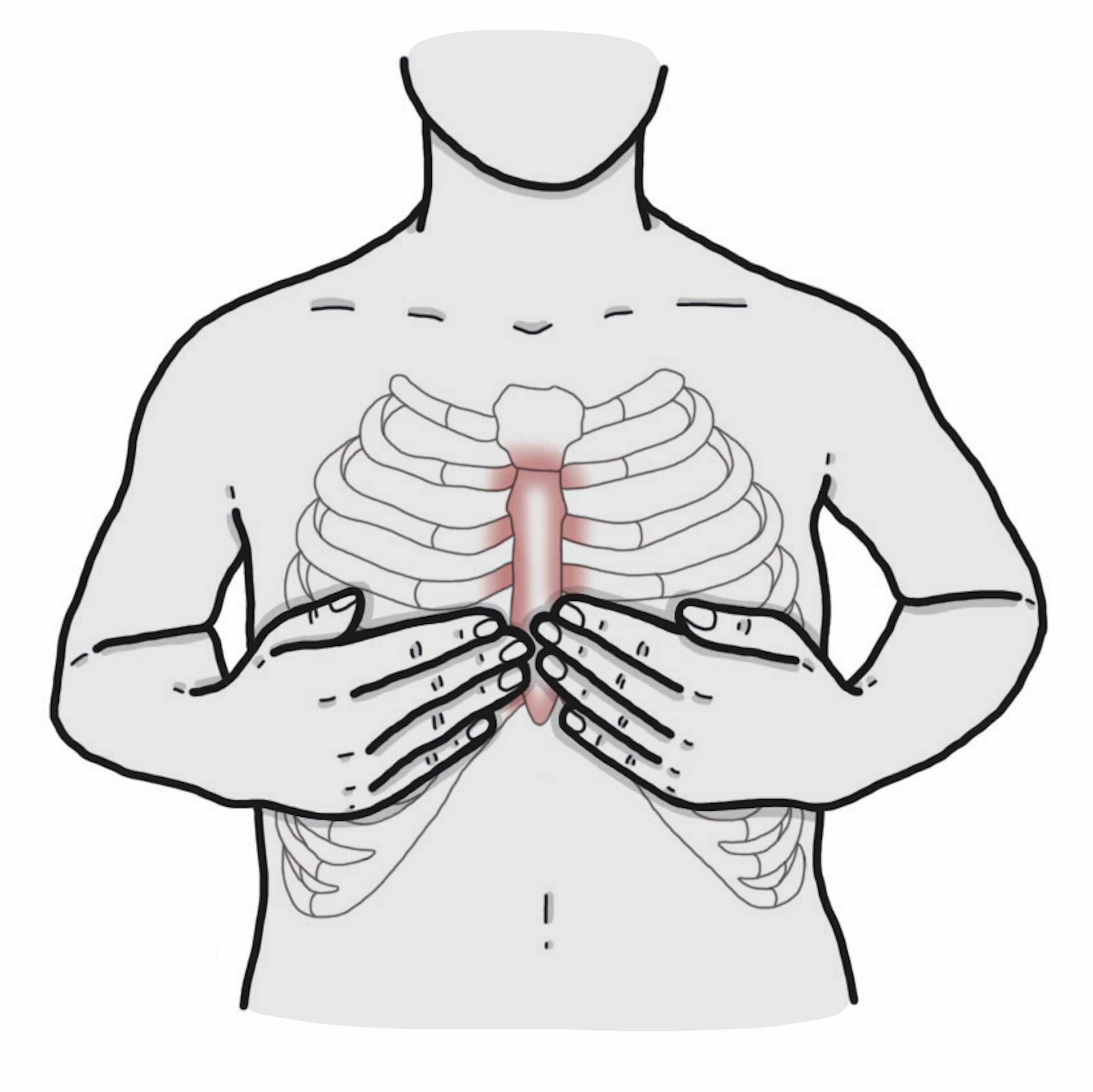 Dor aumenta ao pressionar a área entre as costelas e o externo