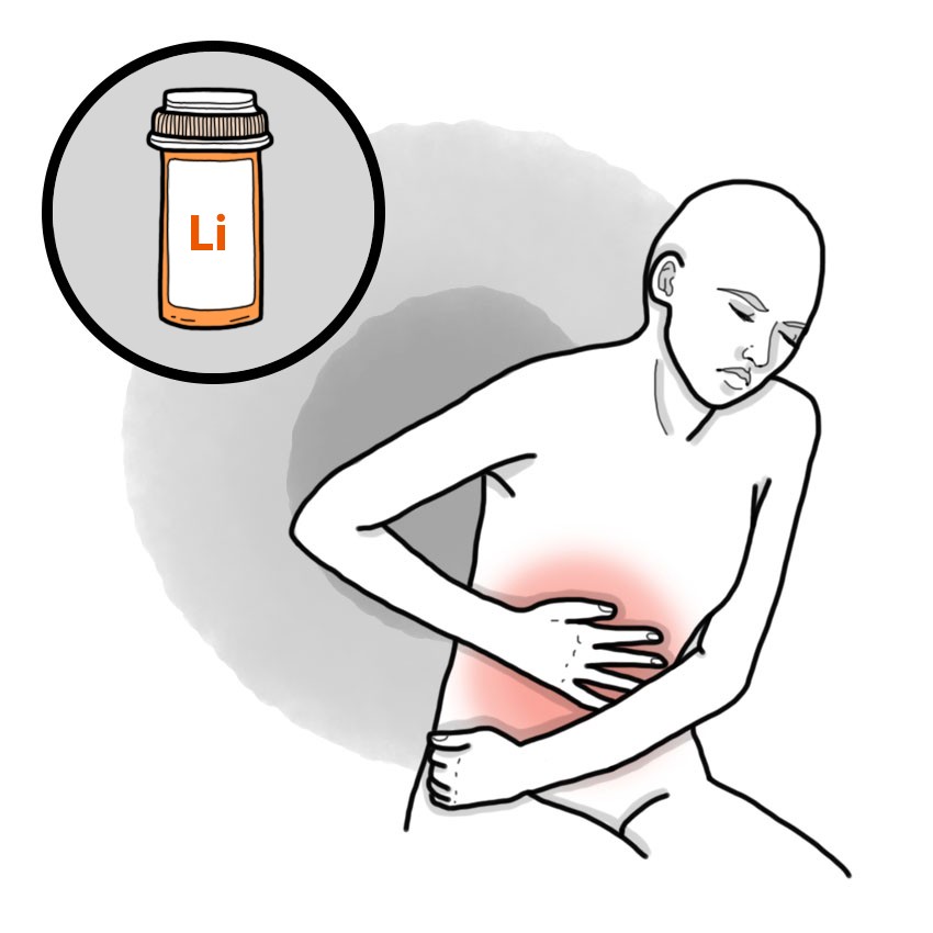 Lithium poisoning