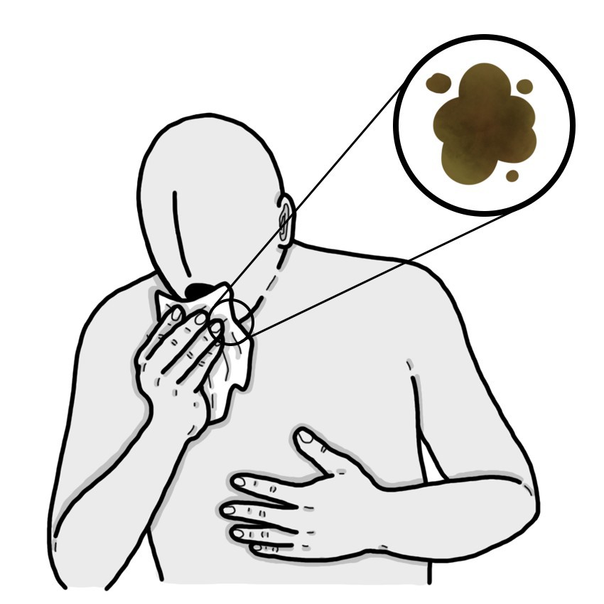 緑っぽい茶色の痰