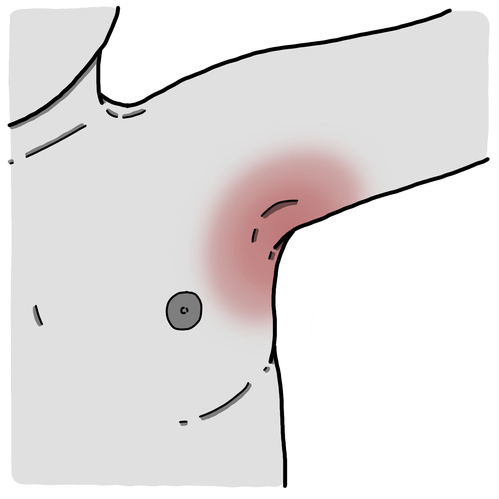 Démangeaisonsdans dans le/s pli/s de/s aisselle/s
