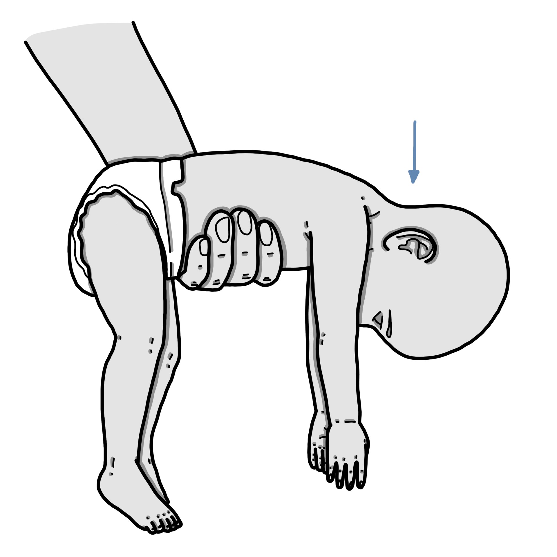 Hypotonie