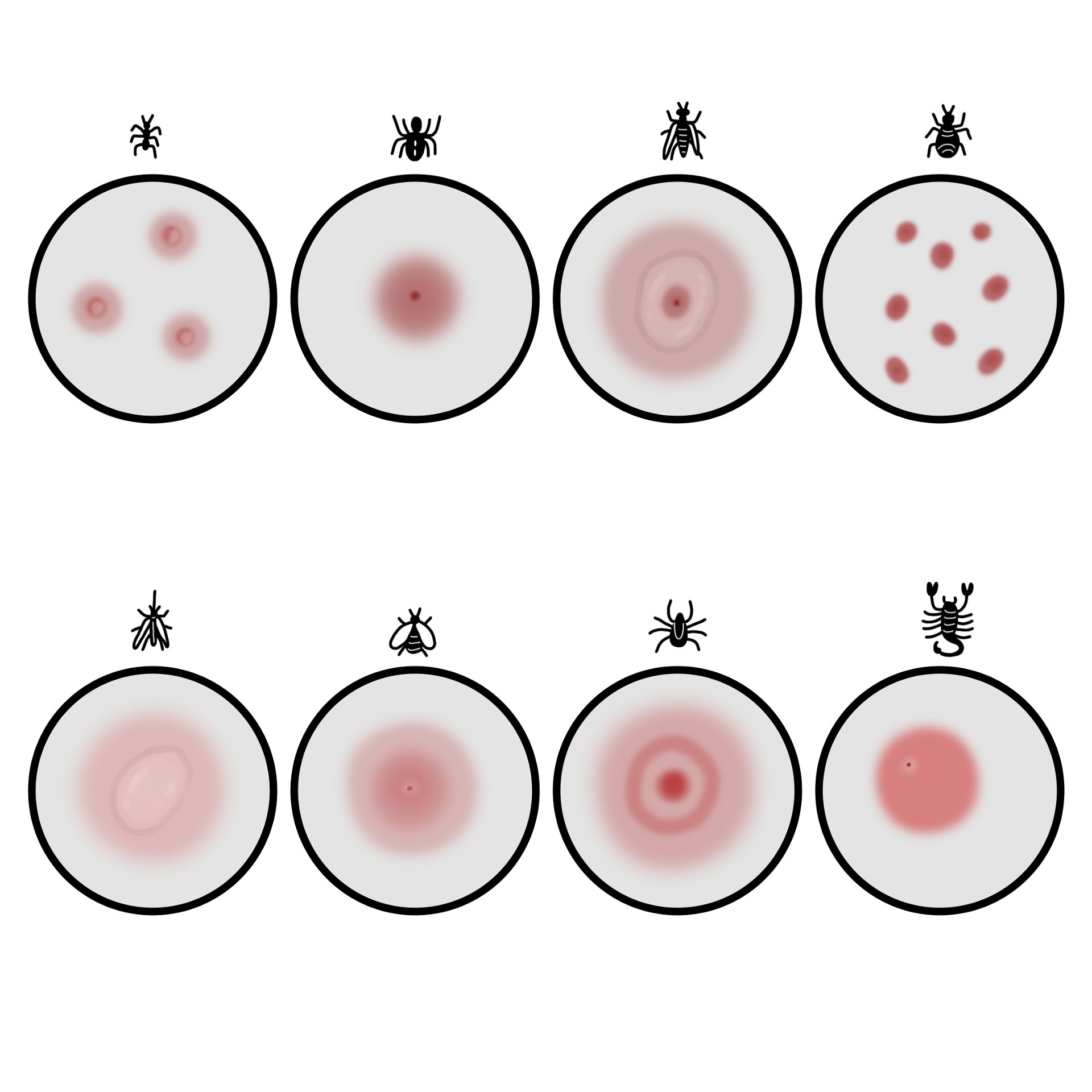 Cutaneous lesion due to insect bite