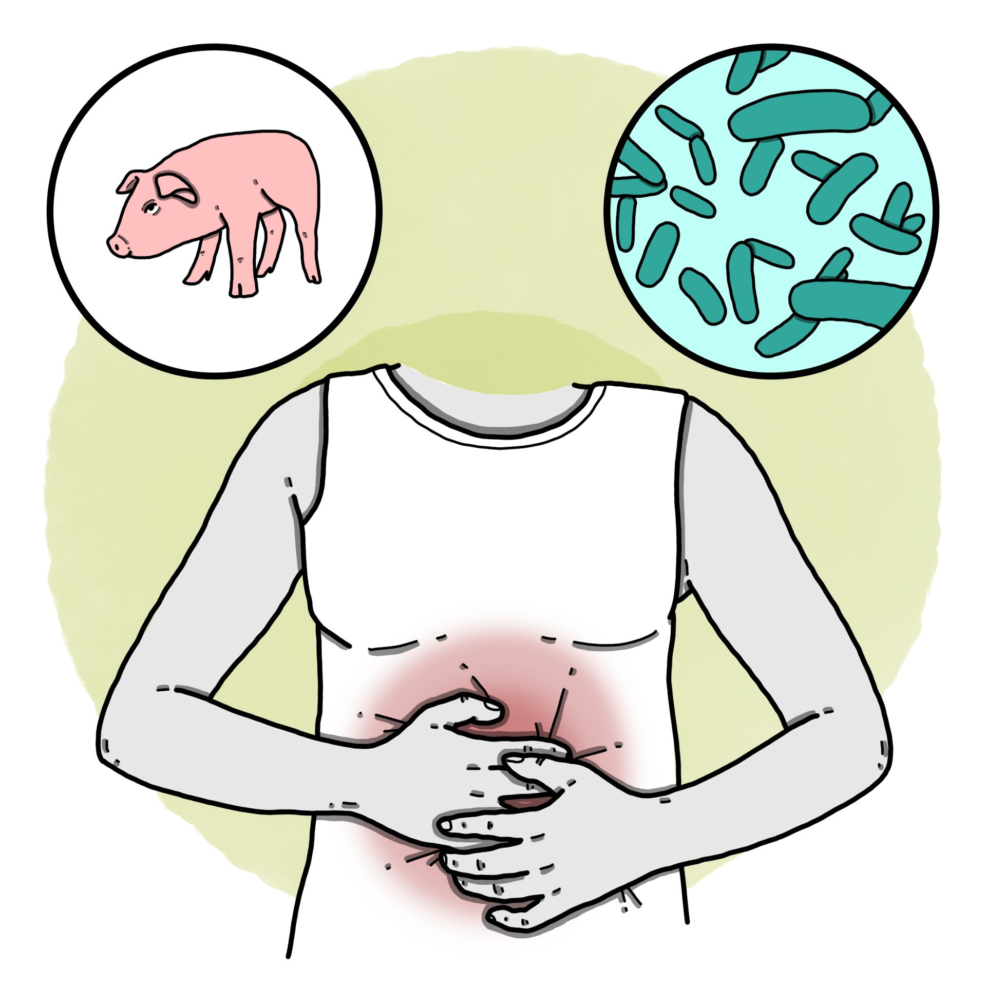 Inflammatory diarrhoea - Invasive diarrhoea or dysentery syndrome