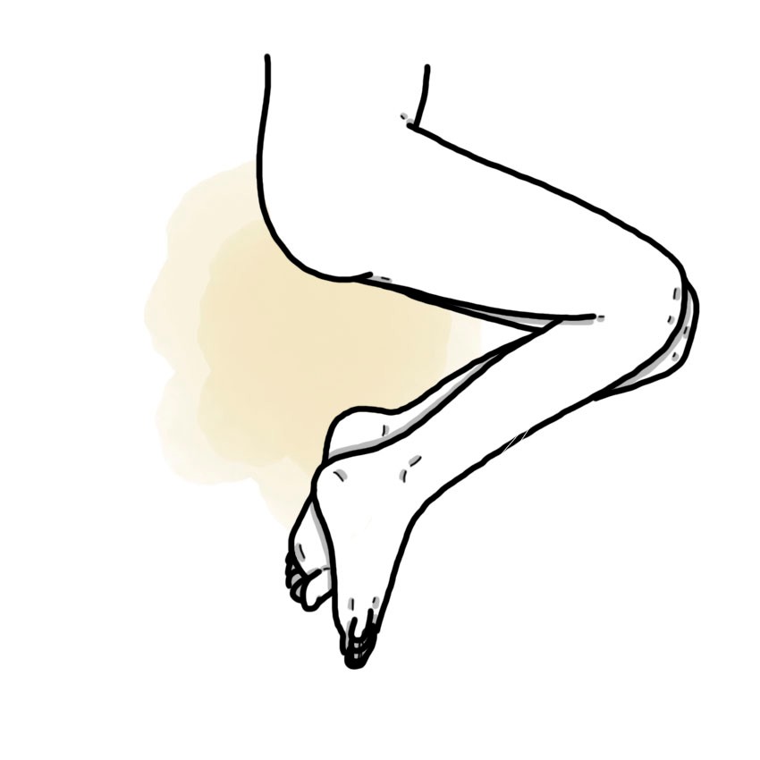 Nocturnal urinary incontinence - Nocturnal enuresis (Paediatrics)