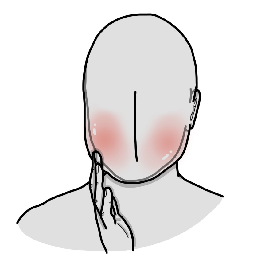 Edema facial