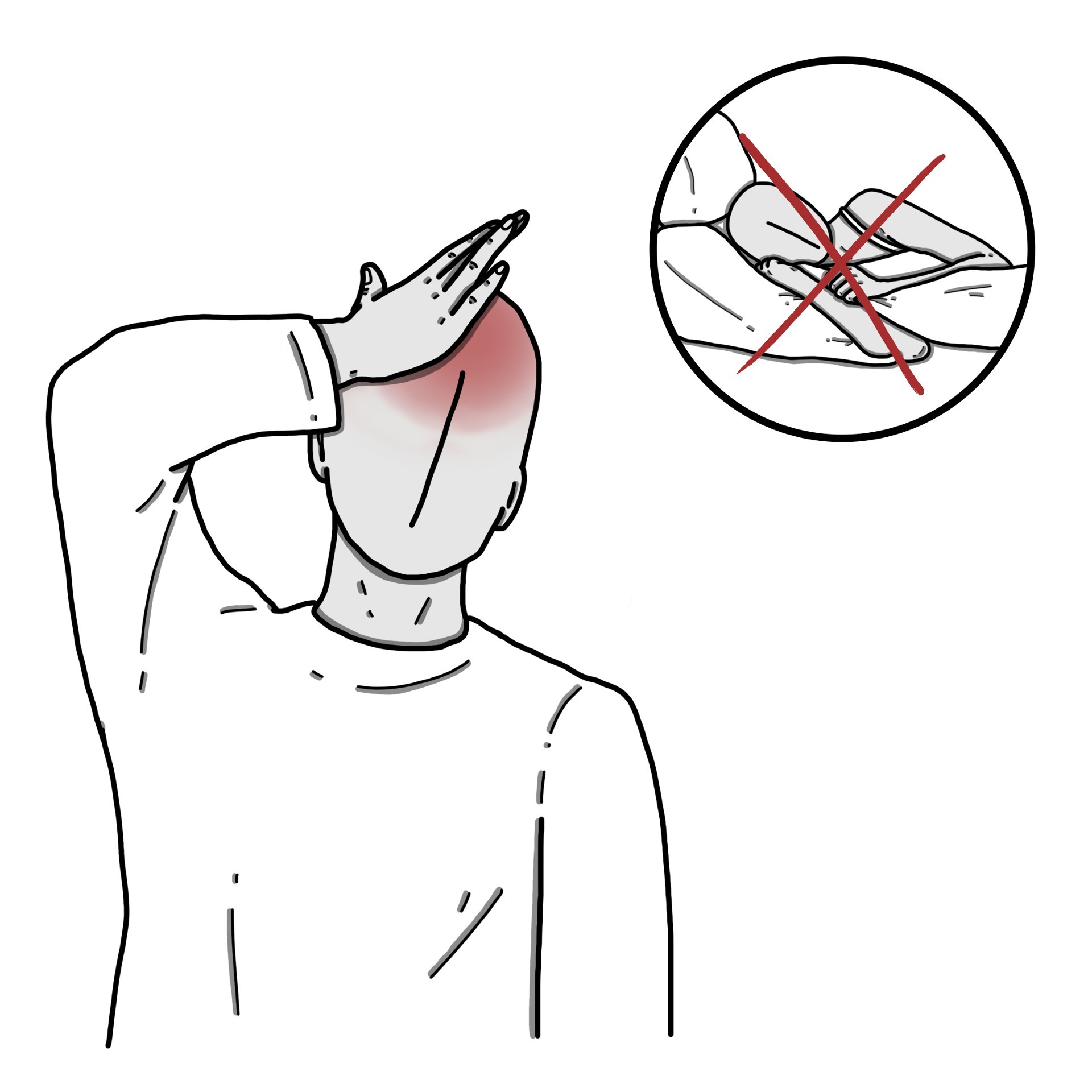 صداع الرأس بسبب قلة النوم