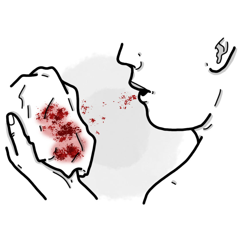 Respiratory bleeding - Haemoptysis
