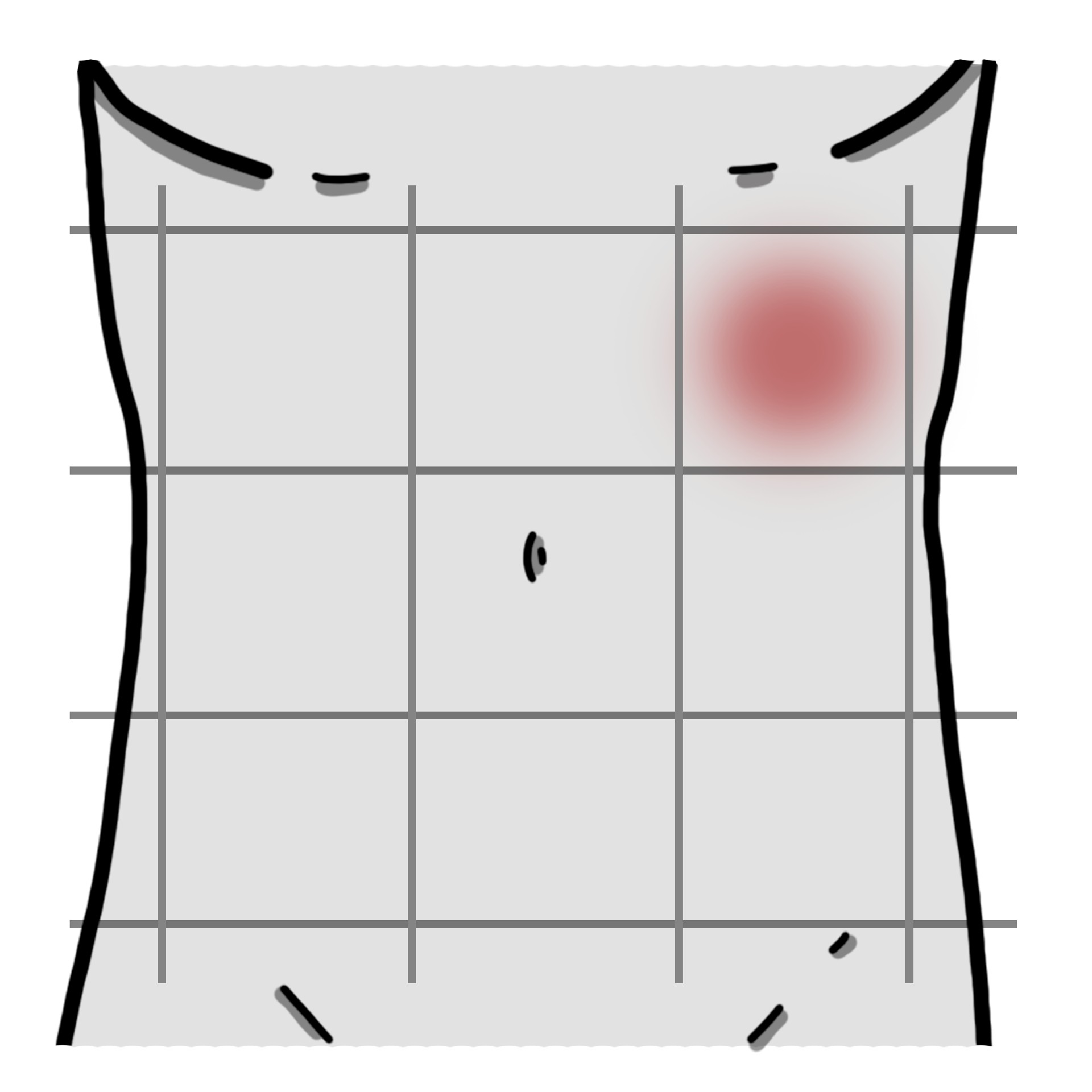 Πόνος στο αριστερό άνω μέρος της κοιλίας