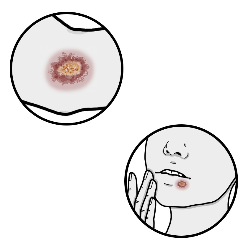 肌および／または唇にある荒れた薄片状の斑点