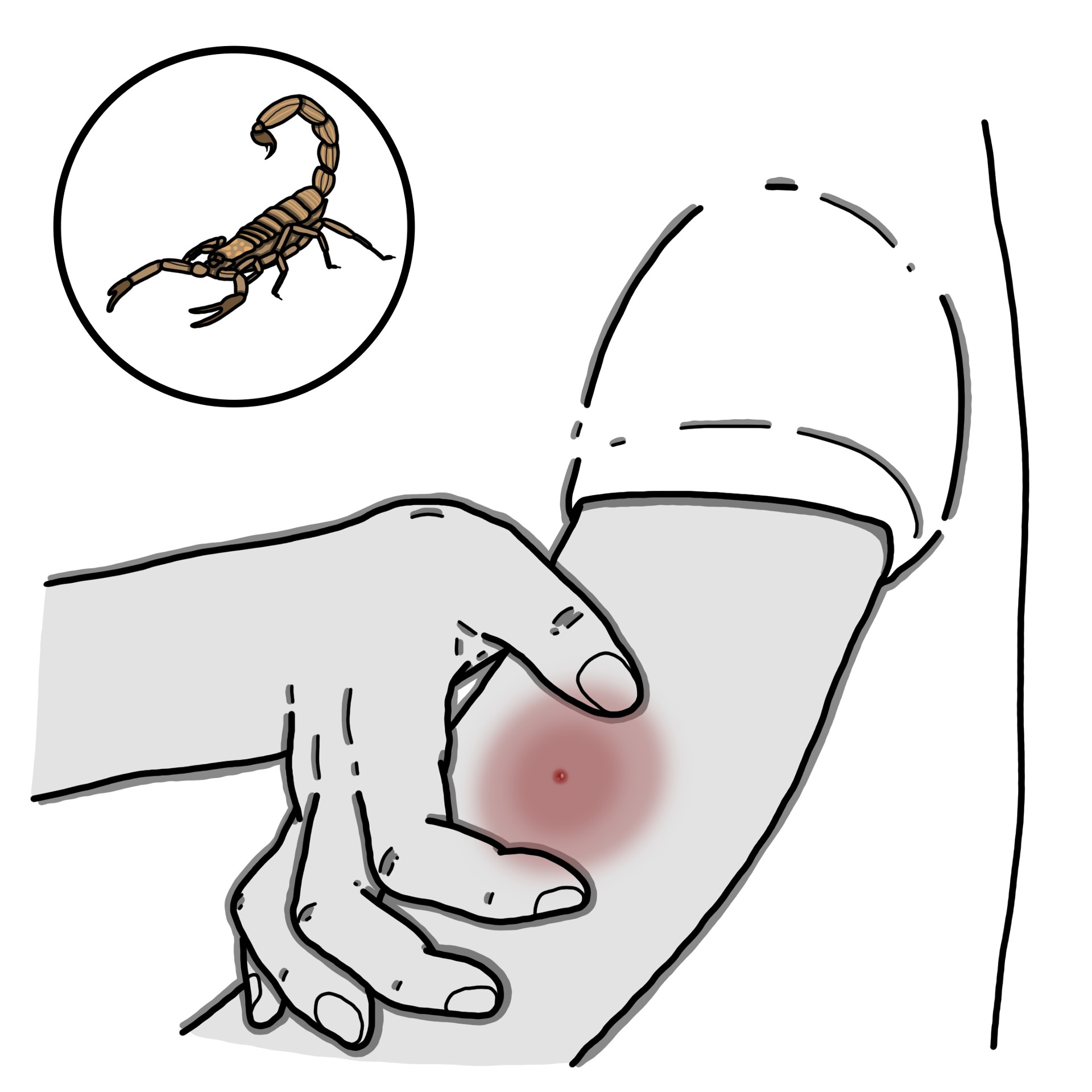 Scorpion sting