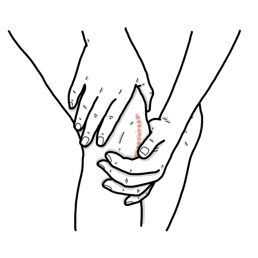 Surgical wound infection