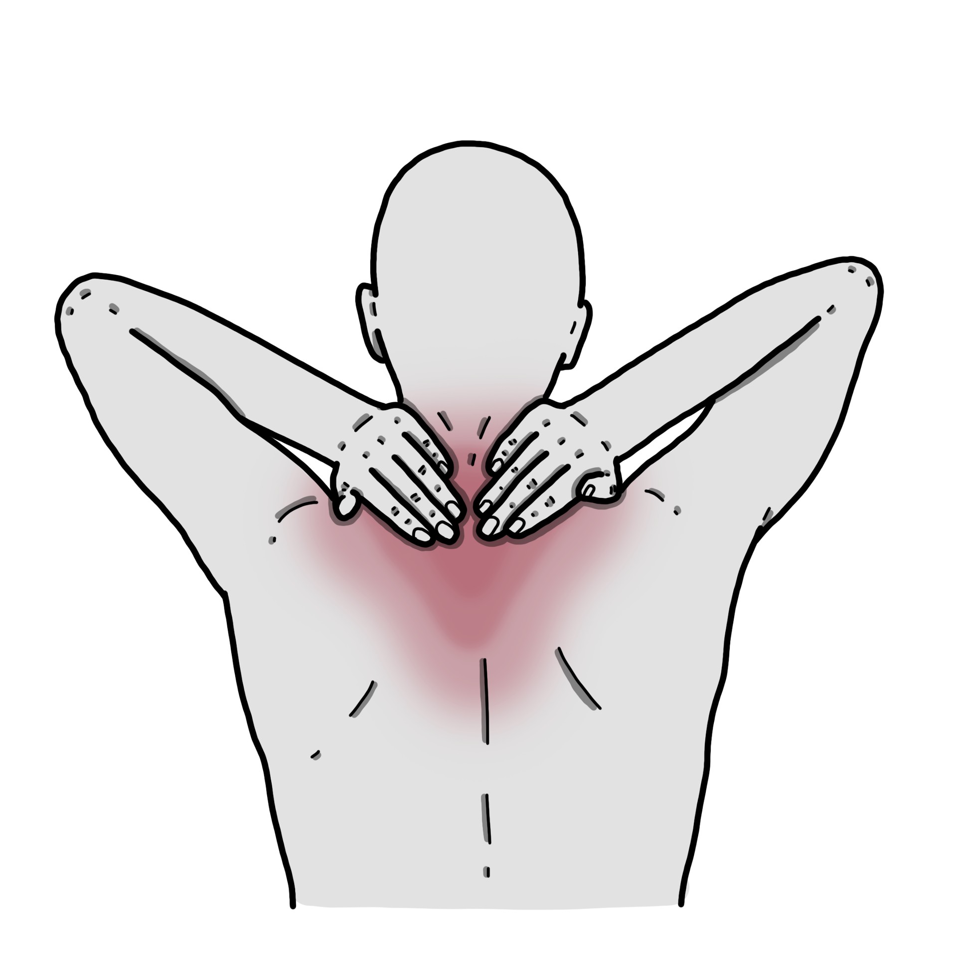 Douleur au niveau du trapèze