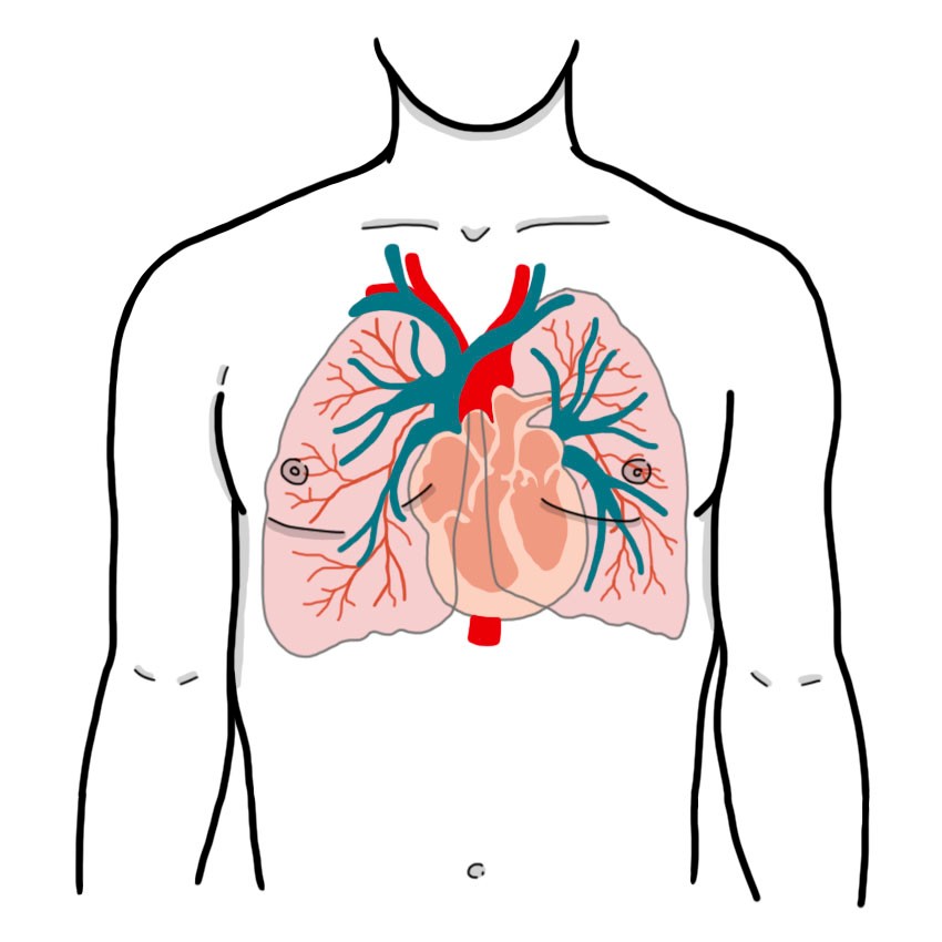 Pulmonary hypertension