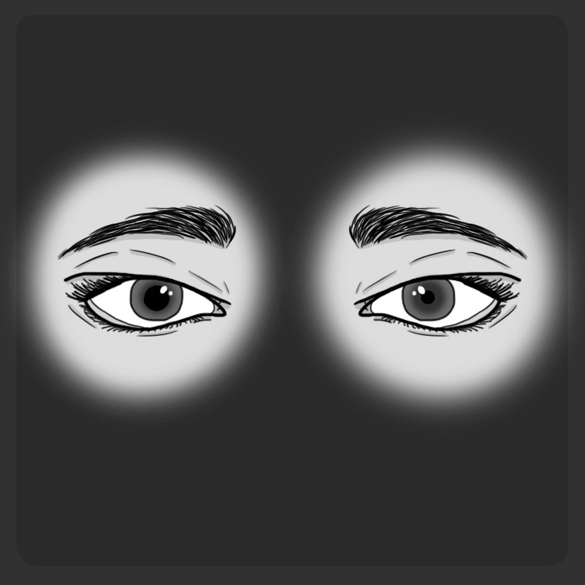 Midriasis media arreactiva unilateral