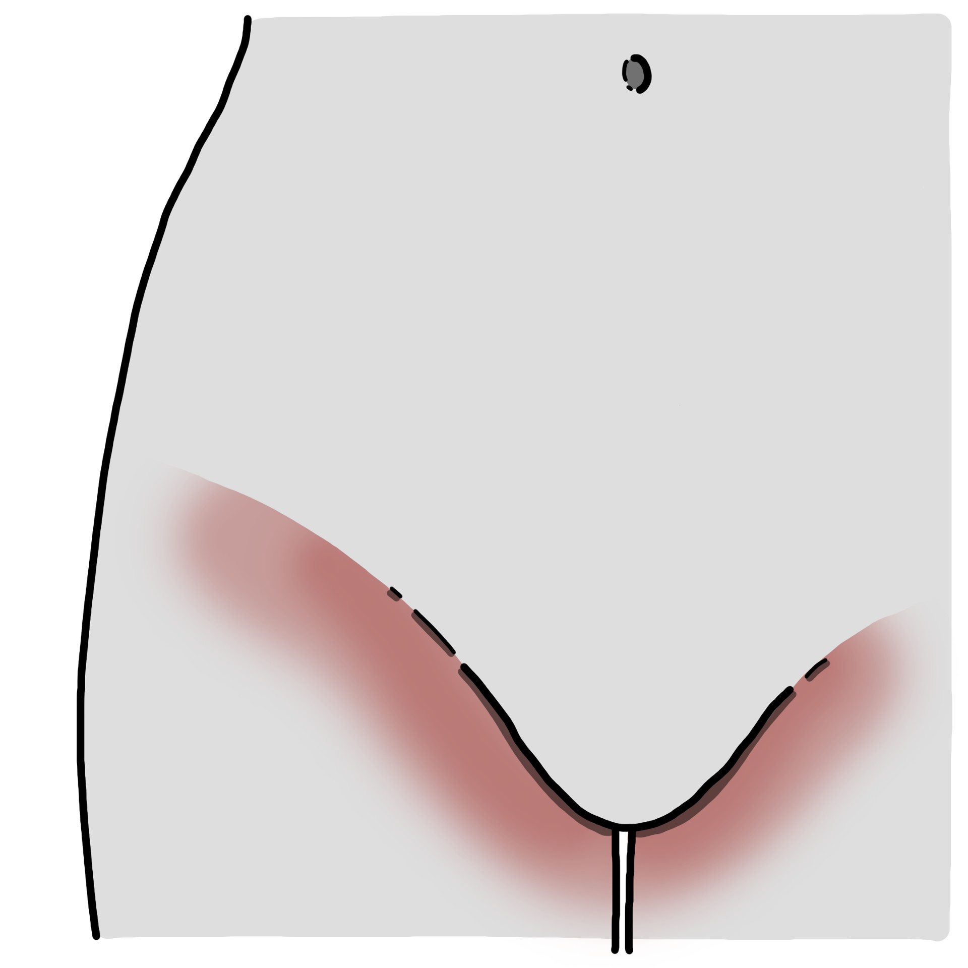 Démangeaisons dans le pli de l'aine