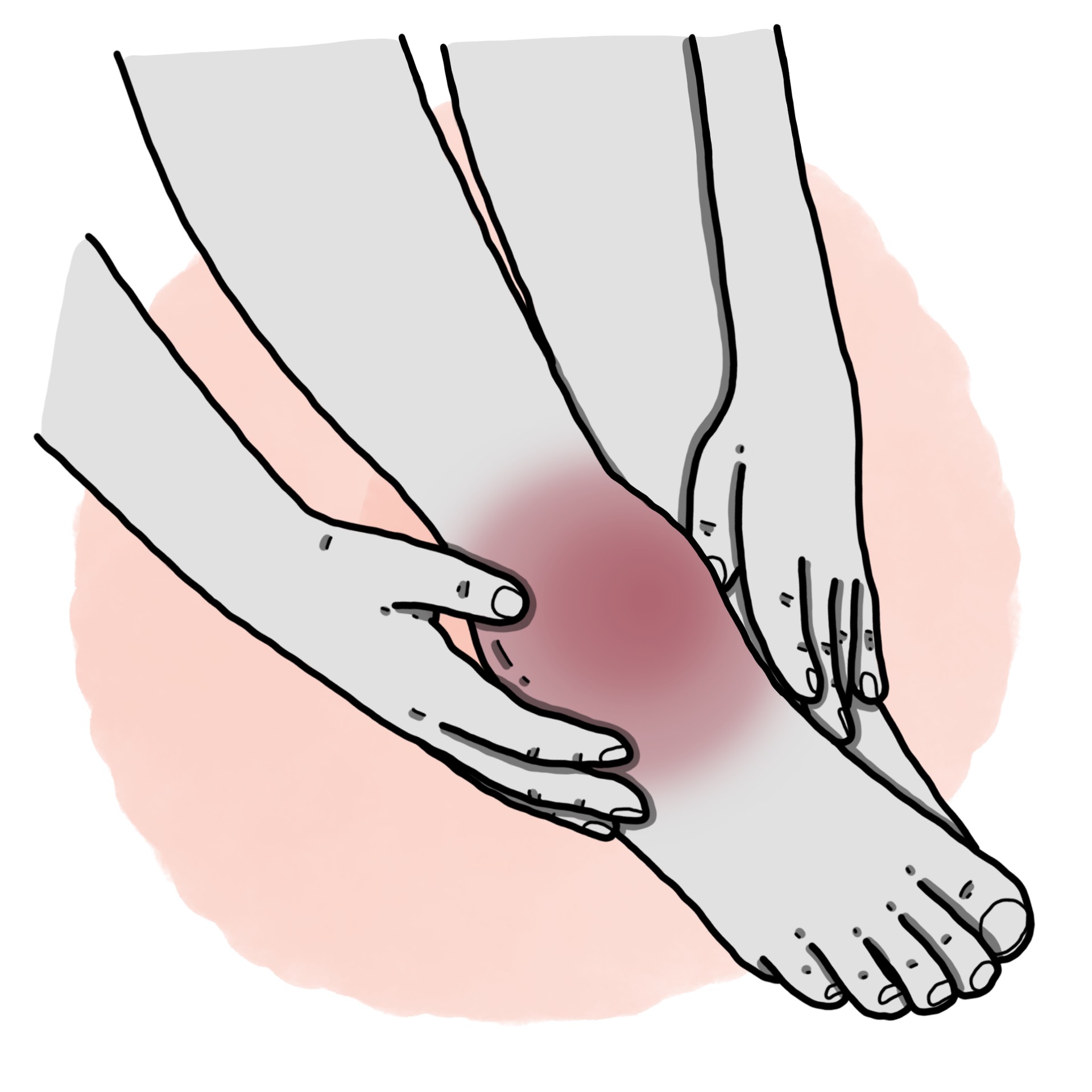 Ankle sprain - Sprained ankle (Paediatrics)