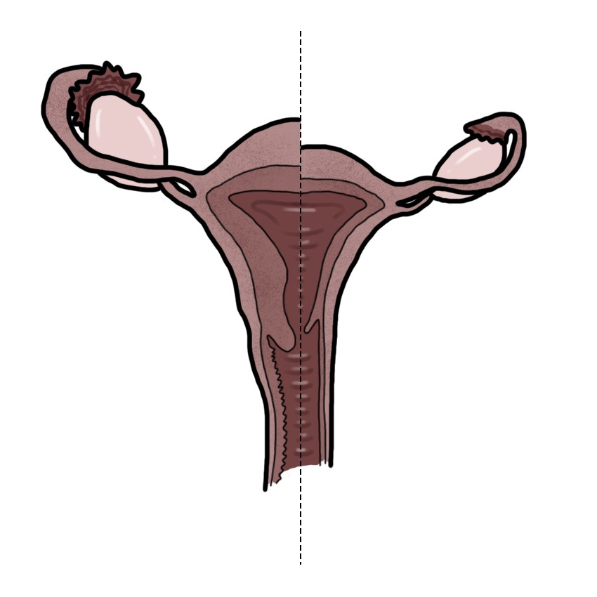 Postmenopausal atrophic vaginitis