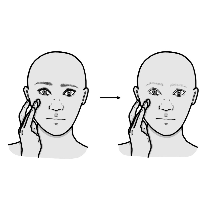 Haarverlies bij wenkbrauwen en wimpers