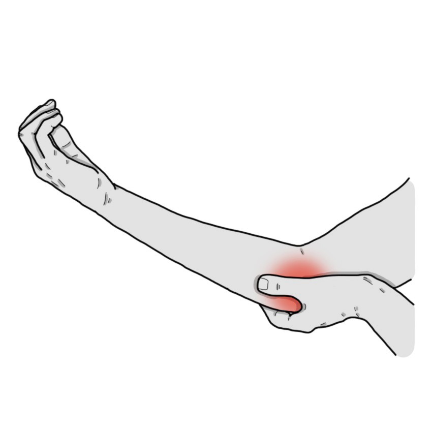 Pain in the inner side of the elbow