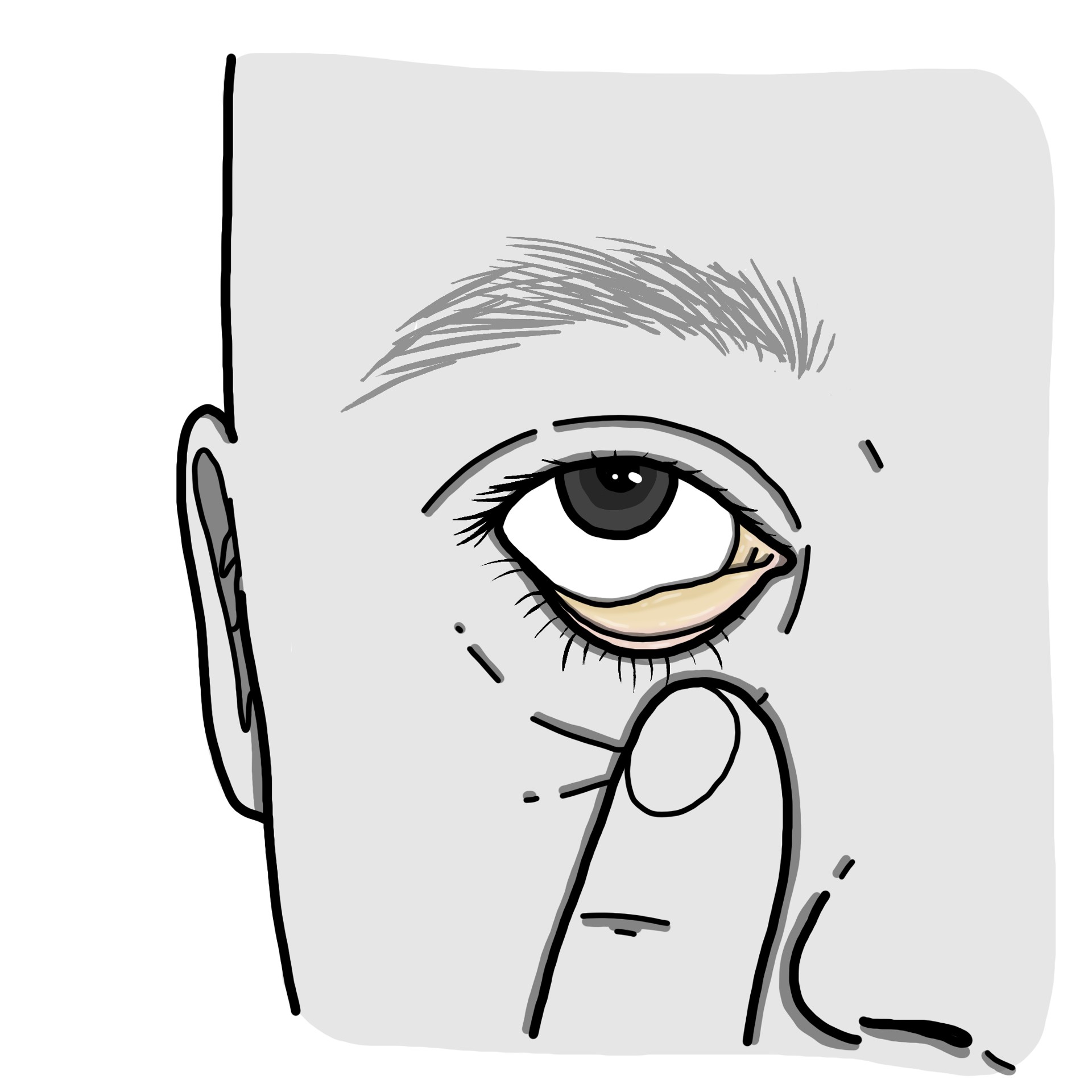 Gele tint van huid en slijmvliezen