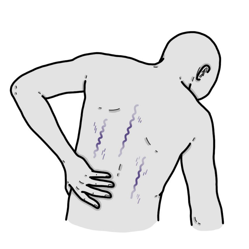 Debilidad muscular en tronco