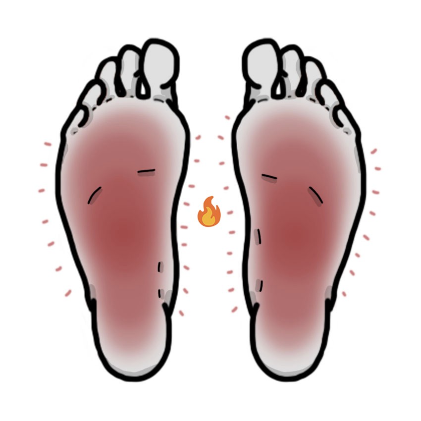 Sensação de ardor e/ou comichão nas solas dos pés