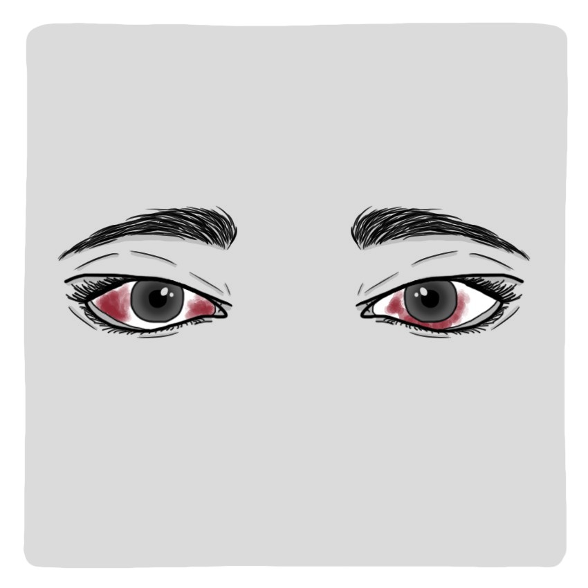 Hémorragie à l’œil