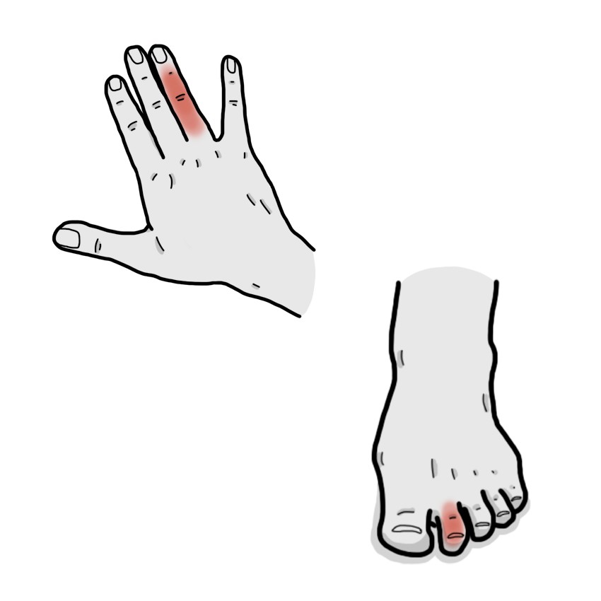 Finger / toe pain