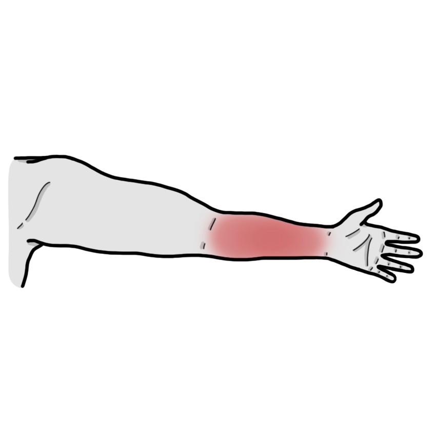 Forearm pain