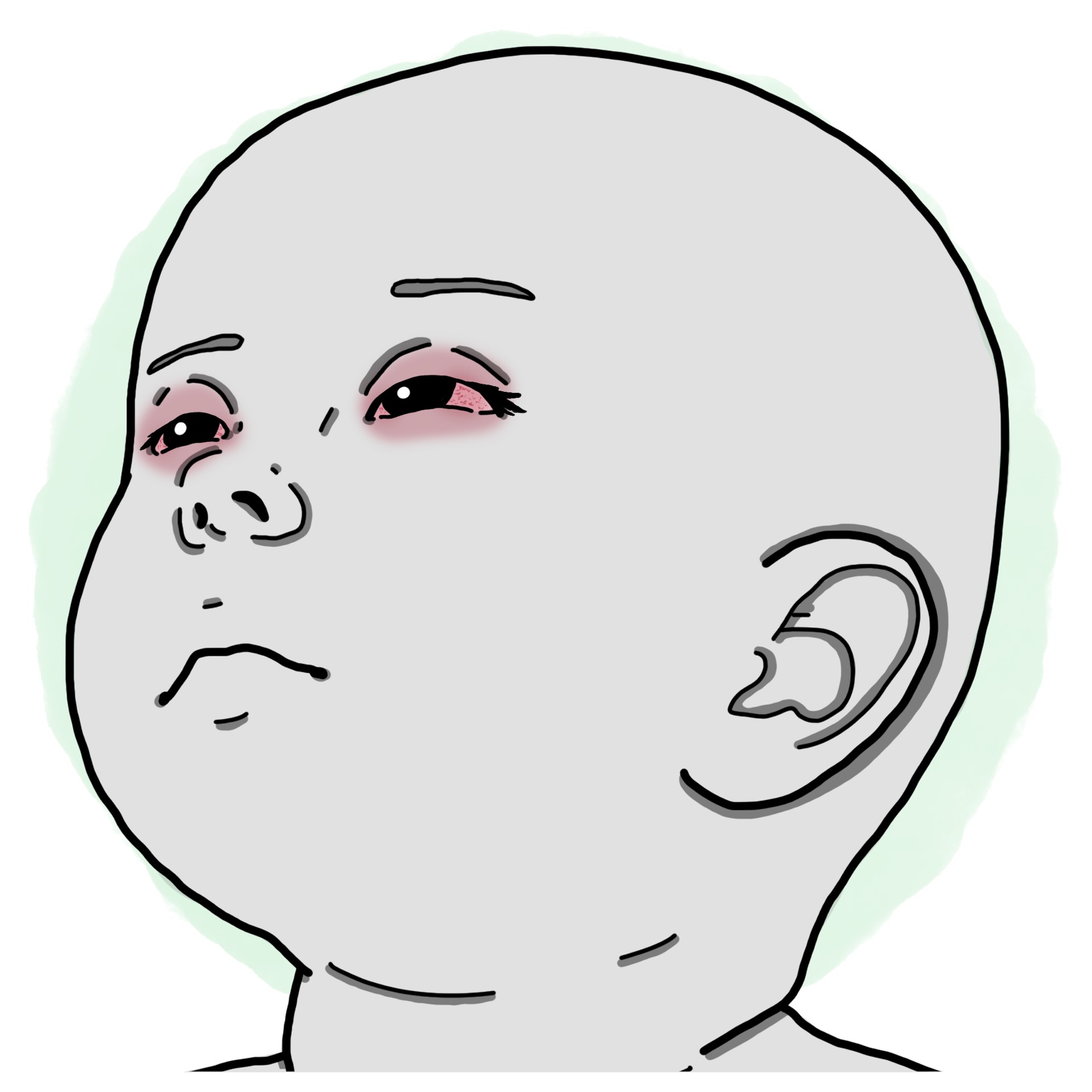 Viral conjunctivitis (Paediatrics)