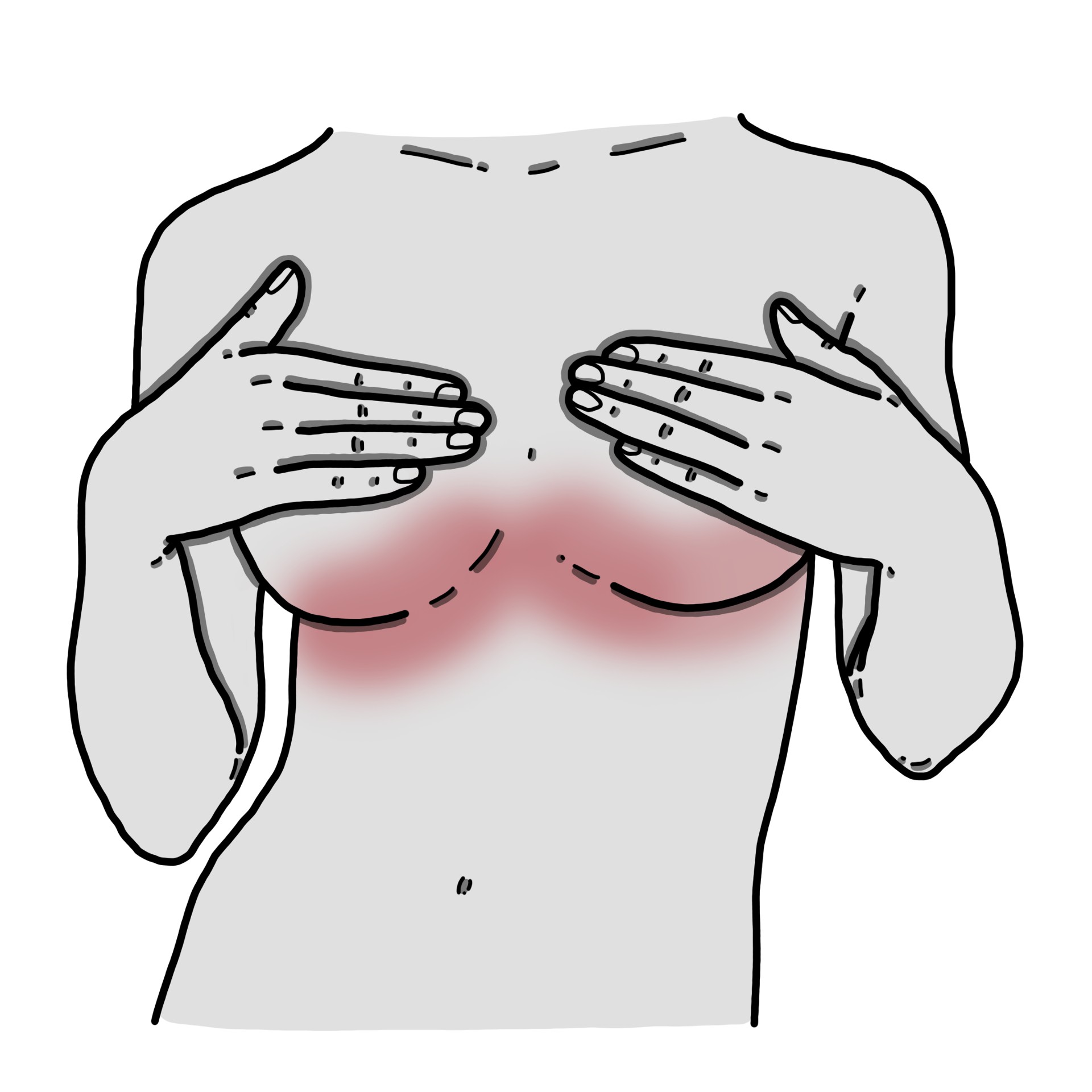 Arrossamento della piega sotto il seno